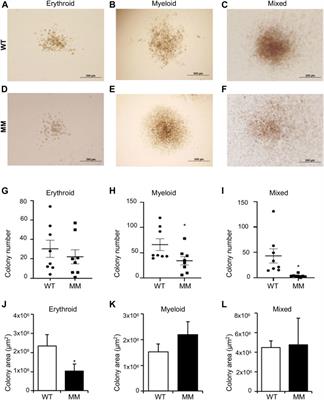 Primitive Erythropoiesis in the Mouse is Independent of DOT1L Methyltransferase Activity